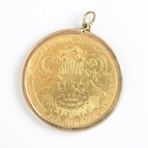 252 - An American $20 coin, within 9ct yellow gold mount, 35gms