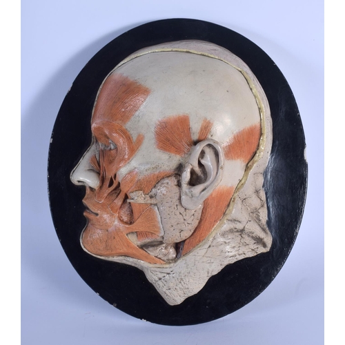 326 - A FRENCH PAINTED POTTERY ANATOMICAL MODEL OF A CUT AWAY HUMAN SKULL depicting muscular structure upo... 