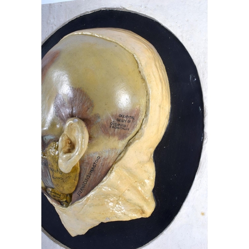 330 - A FRENCH PAINTED POTTERY ANATOMICAL MODEL OF A HALF CUT AWAY HUMAN SKULL depicting various glands an... 