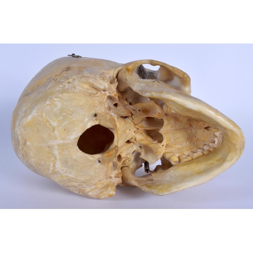 331 - A EUROPEAN ANATOMICAL MODEL OF A SKULL with moving jaw and opening top. 22 cm x 16 cm.