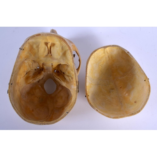 331 - A EUROPEAN ANATOMICAL MODEL OF A SKULL with moving jaw and opening top. 22 cm x 16 cm.