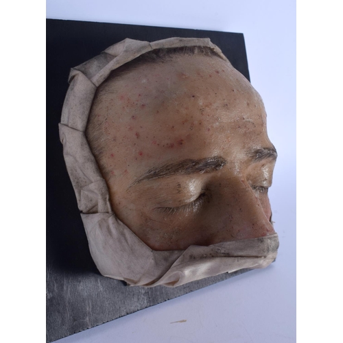 332 - AN UNUSUAL FRENCH ANATOMICAL WAX STUDY OF A DISEASED FACE Folliculitis. 21 cm x 23 cm.