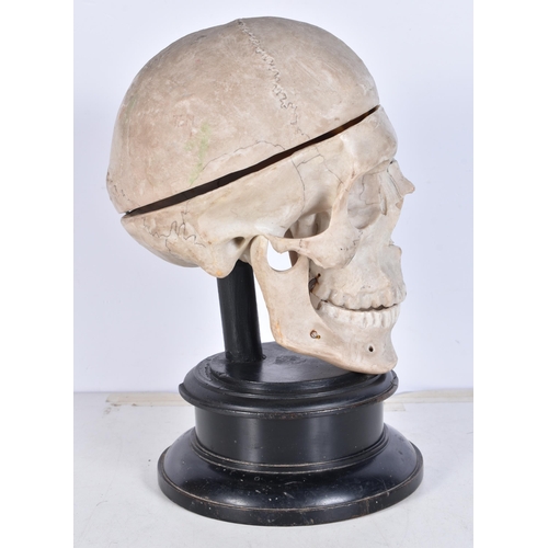 3246 - A mounted anatomical model of a skull