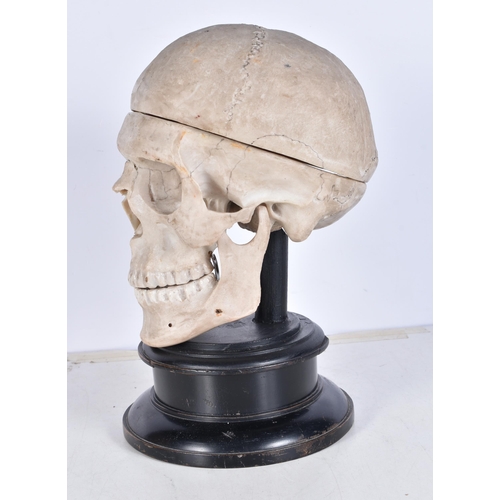 3246 - A mounted anatomical model of a skull