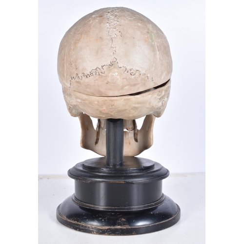 3246 - A mounted anatomical model of a skull