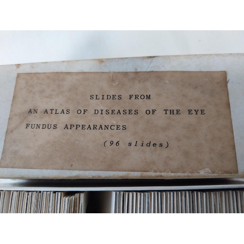 254 - 96 vintage slides from An Atlas of Diseases of The Eye