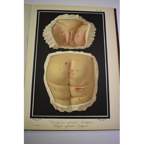 504 - KLEIN (E, MD): 'Atlas of Histology...', London, Smith Elder & Co, 1880: with 48 coloured pl... 