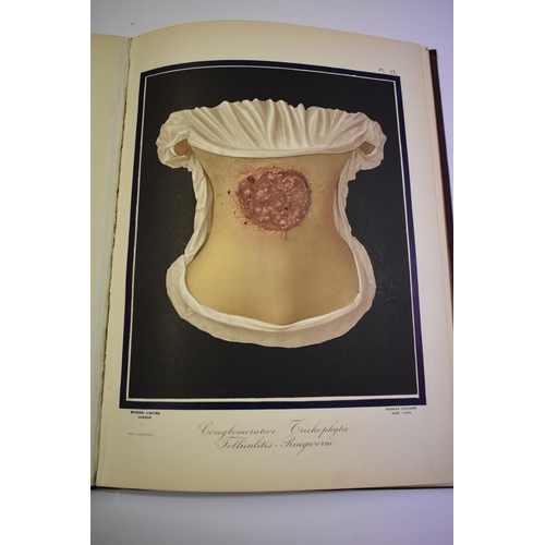 504 - KLEIN (E, MD): 'Atlas of Histology...', London, Smith Elder & Co, 1880: with 48 coloured pl... 