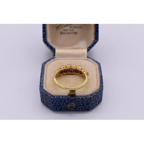 419 - A ruby and diamond gypsy set gold ring, stamped 18, 5.2g total weight, (one stone missing).... 