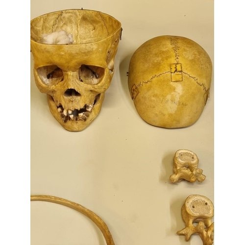 1503 - Anatomy: a human part skeleton, the pine box labelled 'Adam, Rouilly & Co'; with some duplicate ... 