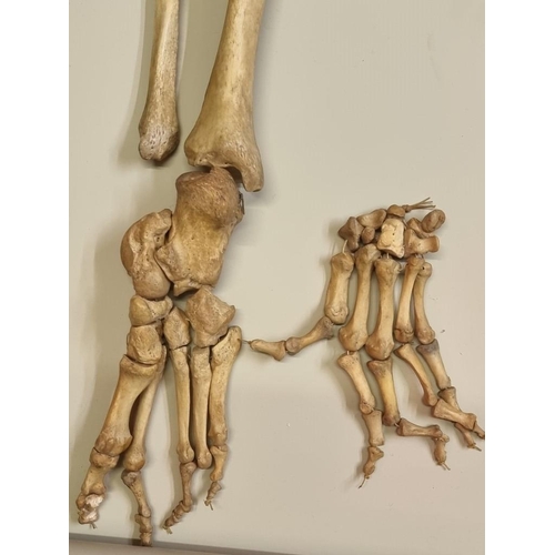 1503 - Anatomy: a human part skeleton, the pine box labelled 'Adam, Rouilly & Co'; with some duplicate ... 