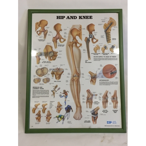 55 - Similar To Previous Lot Vintage Medical Poster Hip And Knee.