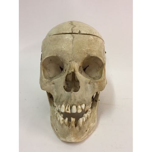 100a - Genuine human medical skull