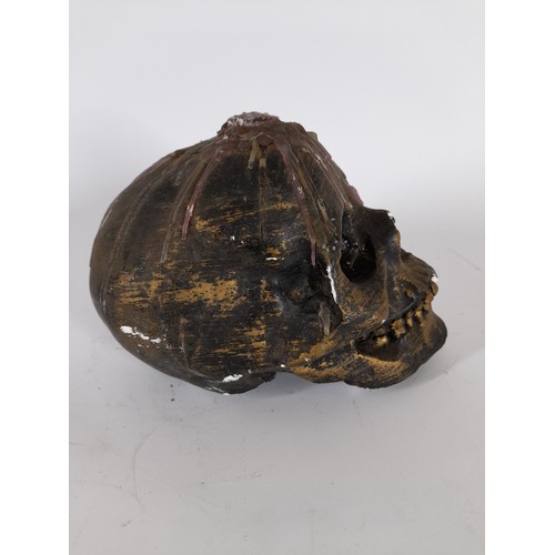 76 - Plaster Skull with dripping wax, bronze painted, 15cm x 20cm