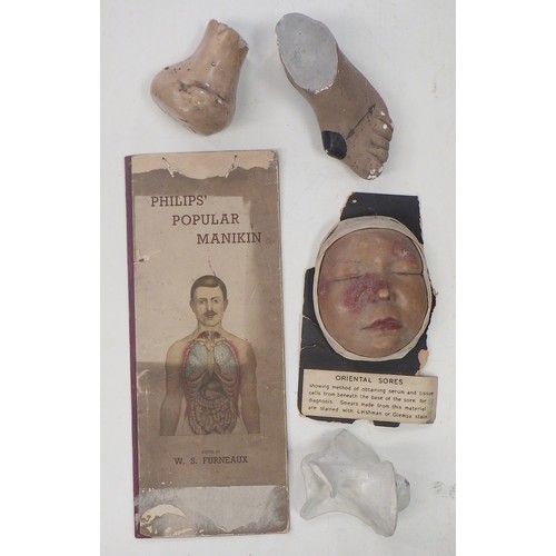 151 - A wax work moulage depicting Oriental Sores on a child's face; other medical interest plasterwork; a... 