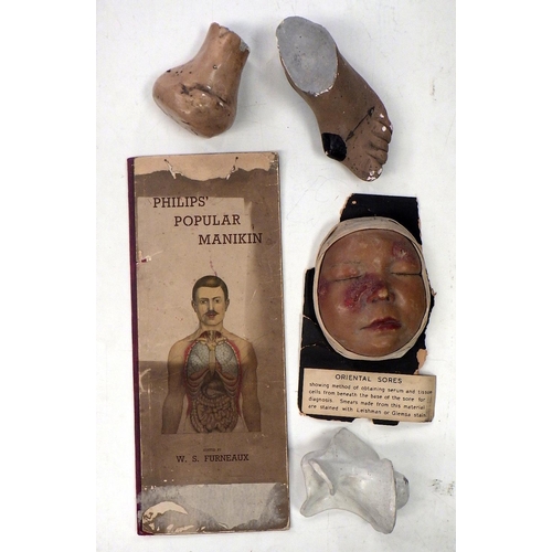 151 - A wax work moulage depicting Oriental Sores on a child's face; other medical interest plasterwork; a... 