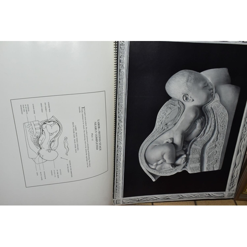 707 - BIRTH ATLAS, three edition of the Dickinson-Belskie publications, two second editions, one fifth edi... 