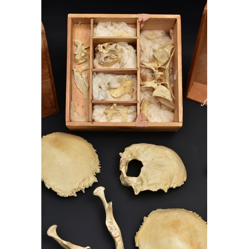 176 - A DECONSTRUCTED HUMAN SKULL IN A WOODEN BOX, the pull off lid interior bears a label for 'Adam Rouil... 