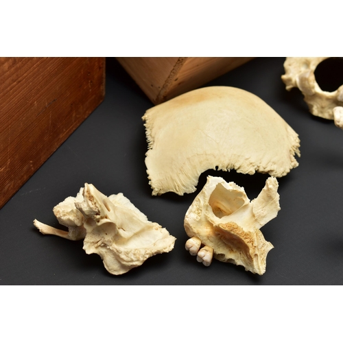 176 - A DECONSTRUCTED HUMAN SKULL IN A WOODEN BOX, the pull off lid interior bears a label for 'Adam Rouil... 