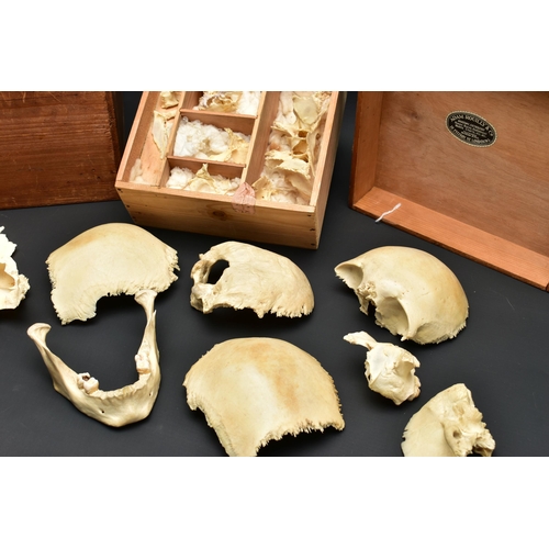 176 - A DECONSTRUCTED HUMAN SKULL IN A WOODEN BOX, the pull off lid interior bears a label for 'Adam Rouil... 