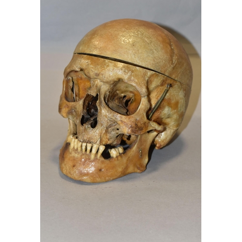 441 - A HUMAN SKULL FOR MEDICAL / ACADEMIC PURPOSES, in two sections, springs to jaw / sides of skull, hei... 