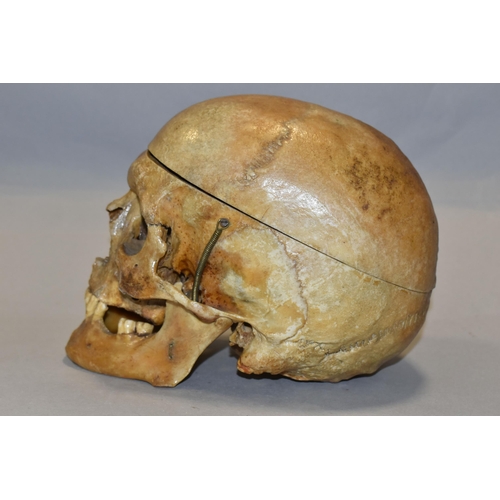 441 - A HUMAN SKULL FOR MEDICAL / ACADEMIC PURPOSES, in two sections, springs to jaw / sides of skull, hei... 