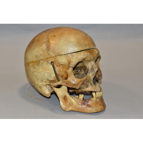 441 - A HUMAN SKULL FOR MEDICAL / ACADEMIC PURPOSES, in two sections, springs to jaw / sides of skull, hei... 