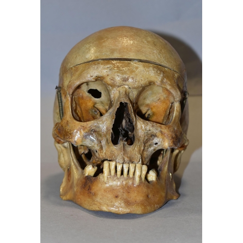 441 - A HUMAN SKULL FOR MEDICAL / ACADEMIC PURPOSES, in two sections, springs to jaw / sides of skull, hei... 