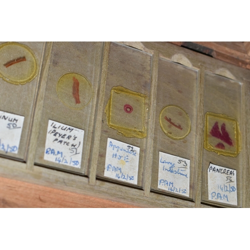 463 - A CASED MICROSCOPE AND VINTAGE PREPARED SLIDES, comprising a B & J Beck Ltd cased microscope, and tw... 