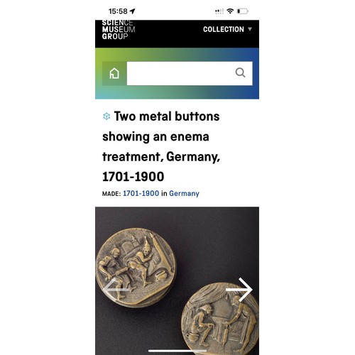 208 - Very Rare Pair Of 19th Century Medical Buttons Depicting Enema, German Origin? Pair In Science Museu... 