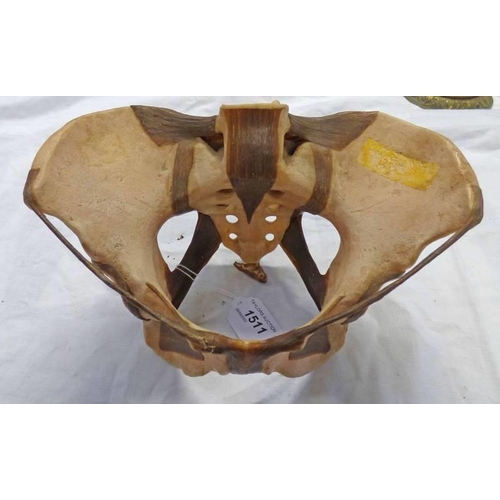 1511 - COMPOSITE MODEL OF A HUMAN HIP BONE, EX MEDICAL DISPLAY