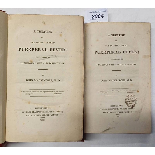 2004 - A TREATISE ON THE DISEASE TERMED PUERPERAL FEVER; ILLUSTRATED BY NUMEROUS CASES AND DISSECTIONS BY J... 