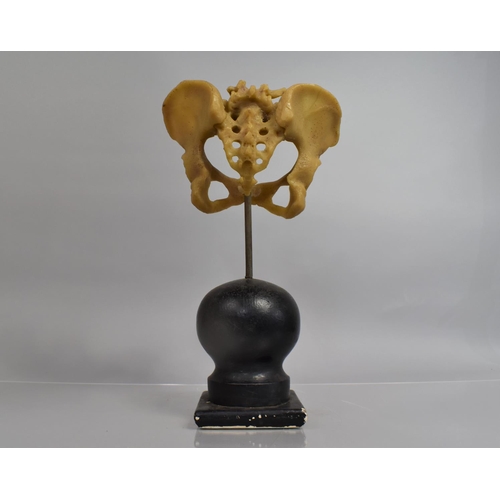 63 - An Early 20th Century Doctors Teaching Aid, A Cast Rubber Model of a Life Size Human Pelvis, Mounted... 