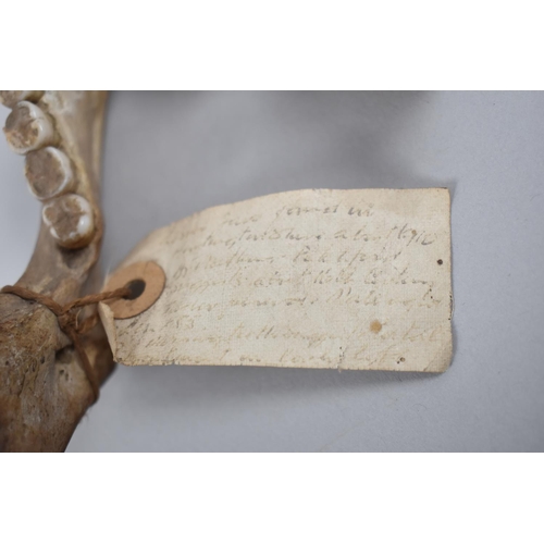 65 - A Human Jaw Bone with Teeth, Inscribed Paper Label Tag but Badly Faded