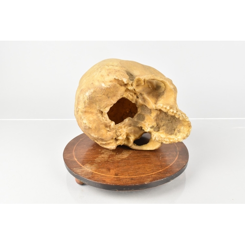 119 - A Late 19th Century Wax Life Size Human Skull Memento Mori, Cast From a Real Human Skull, Supported ... 