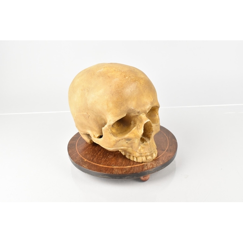 119 - A Late 19th Century Wax Life Size Human Skull Memento Mori, Cast From a Real Human Skull, Supported ... 