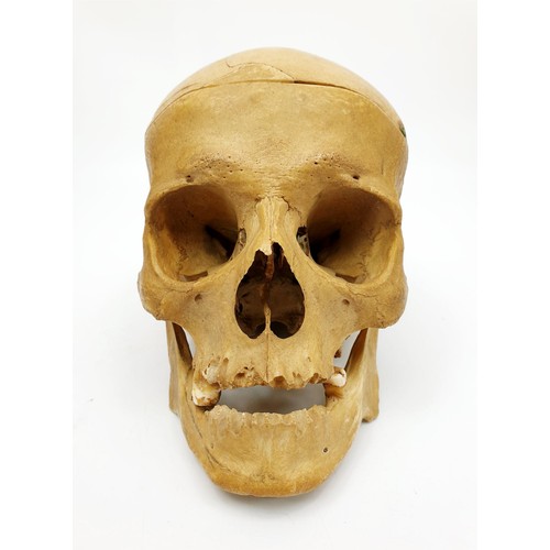 21 - An ex medical  human skull. No shipping. Arrange collection or your own packer and shipper, please. ... 