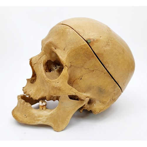 21 - An ex medical  human skull. No shipping. Arrange collection or your own packer and shipper, please. ... 