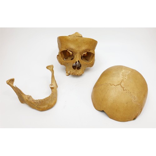 21 - An ex medical  human skull. No shipping. Arrange collection or your own packer and shipper, please. ... 