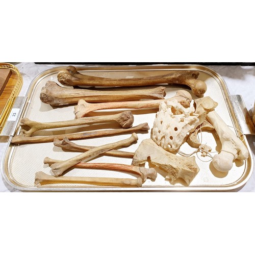 23 - A selection of ex medical human bones. No shipping. Arrange collection or your own packer and shippe... 