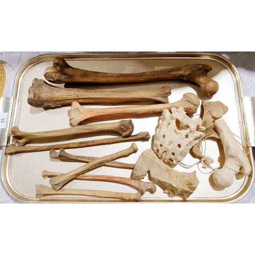 23 - A selection of ex medical human bones. No shipping. Arrange collection or your own packer and shippe... 