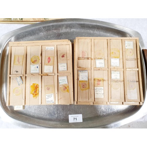 71 - A selection of vintage prepared microscope slides of human tissue. No shipping. Arrange collection o... 