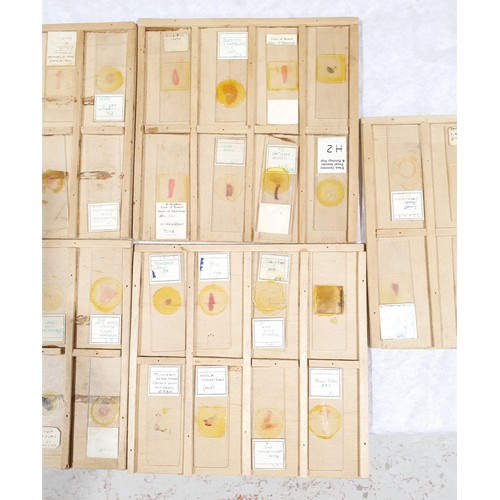 71 - A selection of vintage prepared microscope slides of human tissue. No shipping. Arrange collection o... 