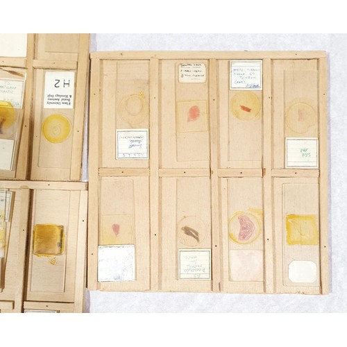 71 - A selection of vintage prepared microscope slides of human tissue. No shipping. Arrange collection o... 