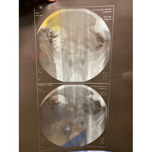 37 - Collection of Abdominal X-Rays and Foot & Ankle CT Scans