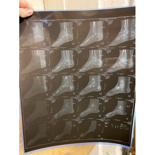 37 - Collection of Abdominal X-Rays and Foot & Ankle CT Scans