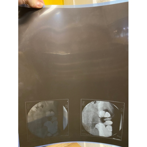 37 - Collection of Abdominal X-Rays and Foot & Ankle CT Scans