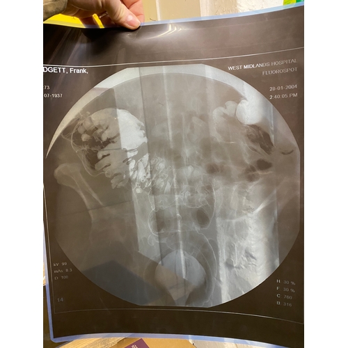 37 - Collection of Abdominal X-Rays and Foot & Ankle CT Scans