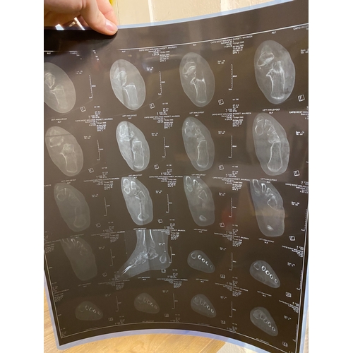 37 - Collection of Abdominal X-Rays and Foot & Ankle CT Scans