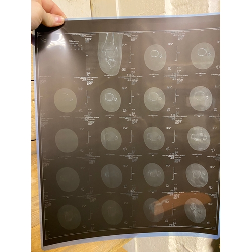 37 - Collection of Abdominal X-Rays and Foot & Ankle CT Scans